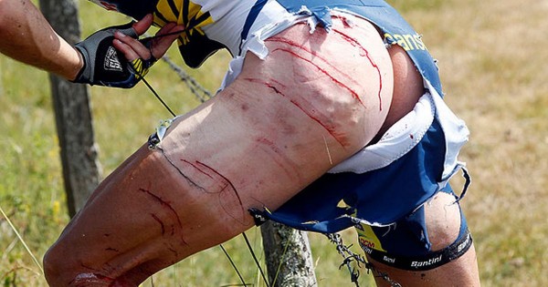Remember this from the Tour a few years back? Johnny Hoogerland after getting run off the road by a race vehicle, into a barbed wire fence.