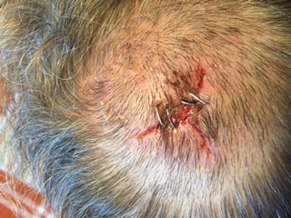 The put a bunch of staples in.  I'm not sure when those or getting removed.
