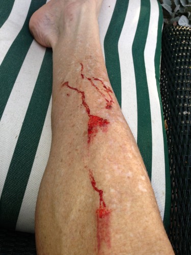 My shin after slipping on a rock, extracting Stanley from the river.