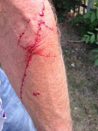 I ripped my arm up mowing on a thorn bush before we left.