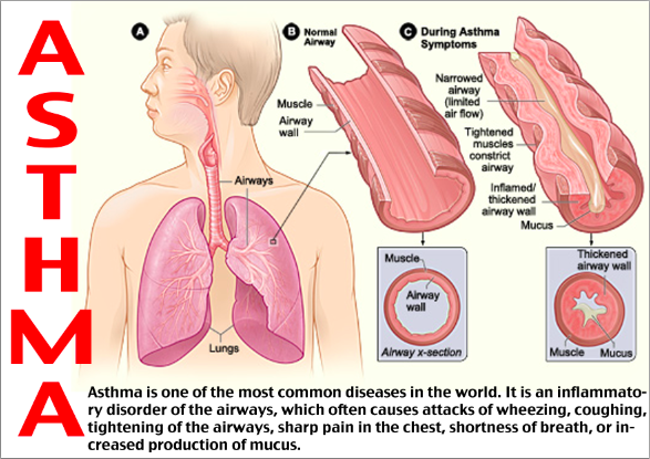 world-asthma-day-2