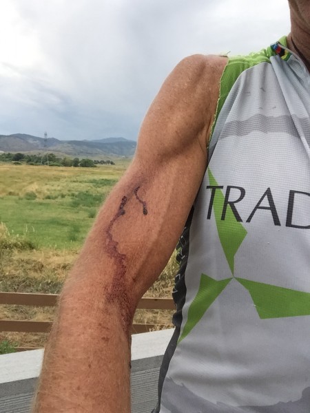 I think you're always bleeding just a little when training and racing MTB.